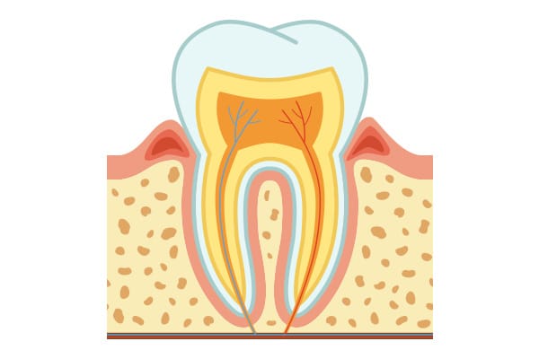 https://dentistkorkutgursoy.com/tr/wp-content/uploads/sites/7/2021/03/gingivitis.jpg