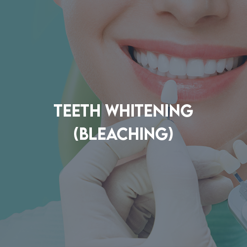Teeth Whitening ( Bleaching )
